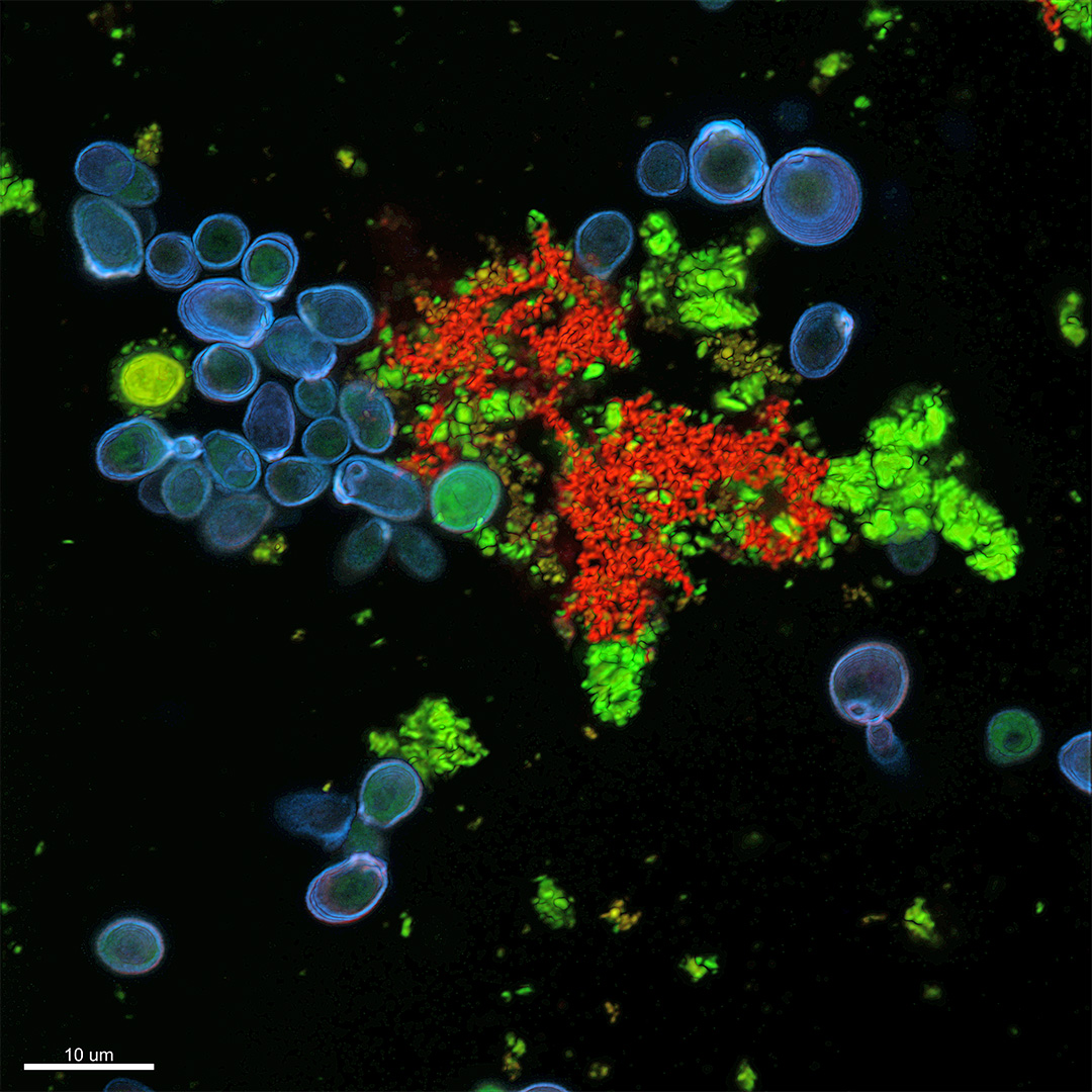 Electron microscopic image of yeast cells used for the project